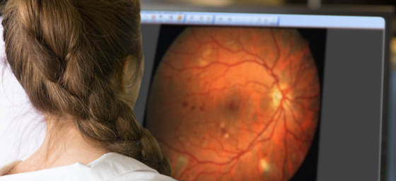 Doctor looking at image of an eye on a computer monitor.